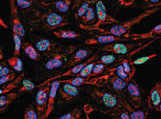 Fluorescence Imaging